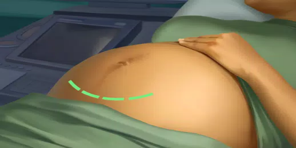 Operate Now : Hospital