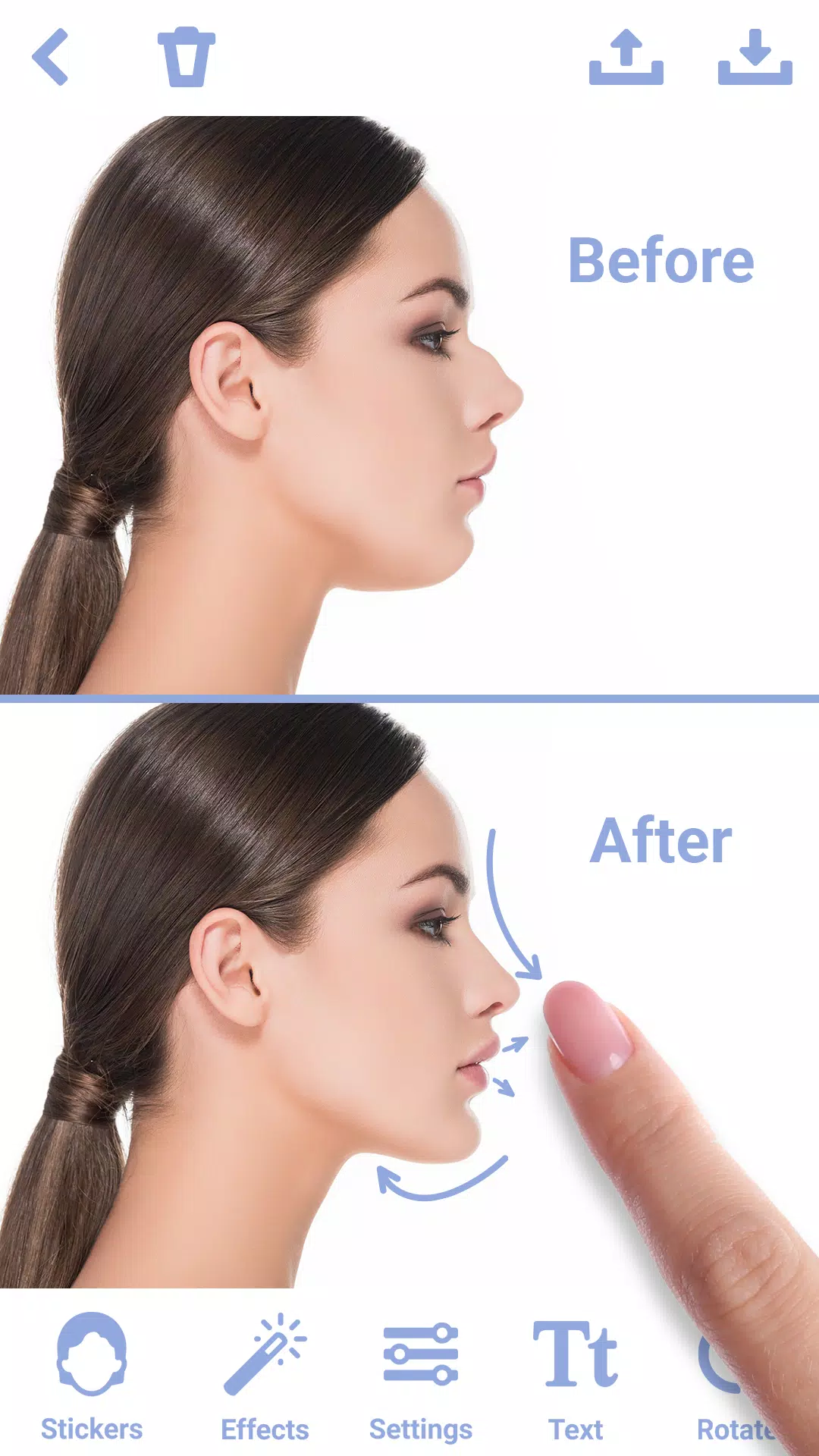 Rhinoplasty應用截圖第0張