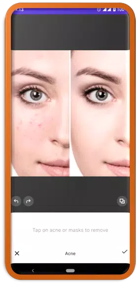 Facetune Editor-Smooth skin ဖန်သားပြင်ဓာတ်ပုံ 0